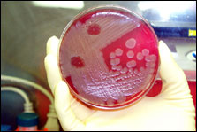 A sampling of Bacillus anthracis - Anthrax