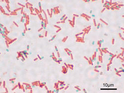 Sporulating Bacillus subtilis 
