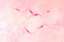 Photomicrograph of Giemsa-stained Trypanosoma cruzi crithidia. Source: CDC