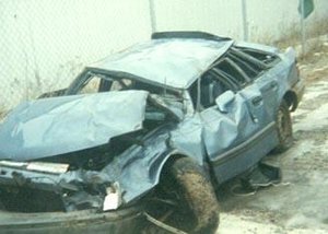 The drunk driver of this car was left disfigured, blind, and permanently brain damaged.