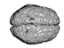 Human brain viewed from above, showing cerebral hemispheres. The front of the brain is to the right.