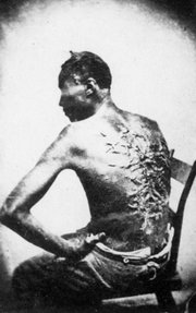 Peter, a slave from , 1863. The scars are a result of a whipping by his overseer, who was subsequently discharged. It took two months to recover from the beating.