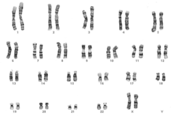 Human female karyotype, giemsa banded