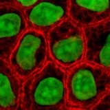 Cells in culture,  for  (red) and  (green)
