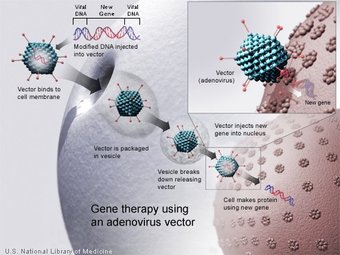 Gene therapy using an  vector. A new gene is inserted into an adenovirus vector, which is used to introduce the modified  into a human cell. If the treatment is successful, the new gene will make a functional .