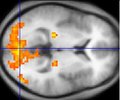 fMRI data