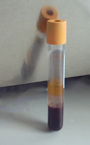 A large SST vacutainer.